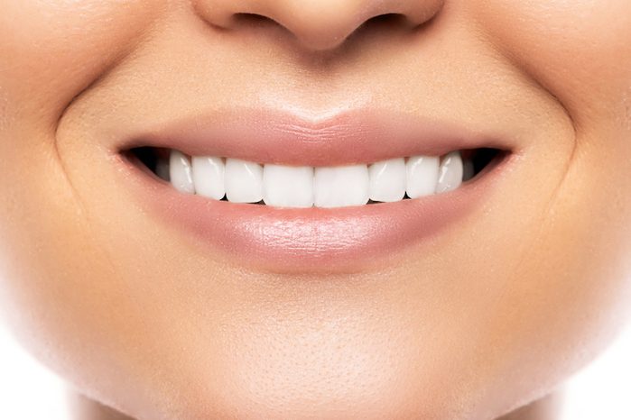 porcelain veneers treatment in burkburnett, texas