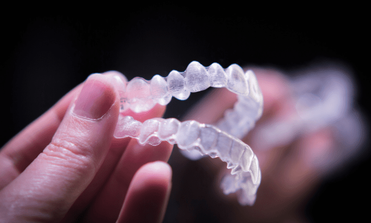 Fluoride and Clear Aligners